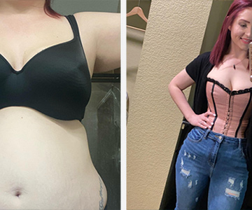 Skilee's Amazing Weight Loss Transformation Story 